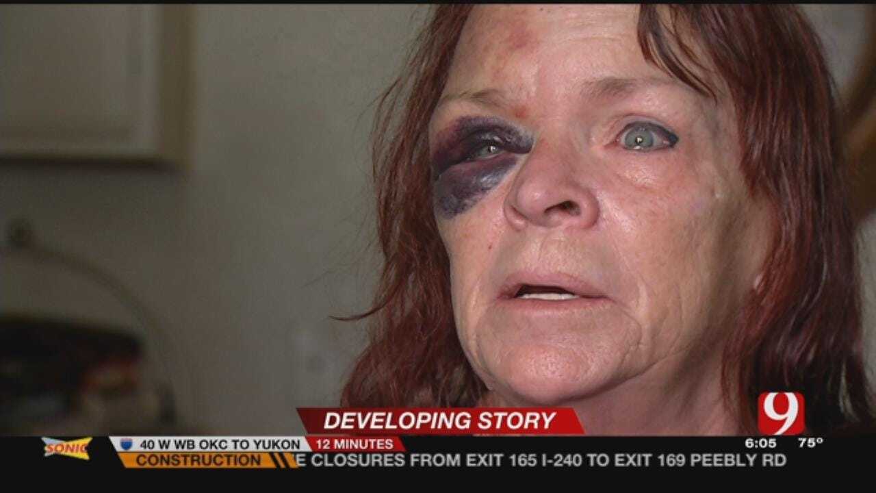 Moore Mother Reportedly Beaten By Son