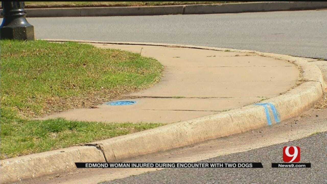 Edmond Woman Injured During Encounter With Two Dogs
