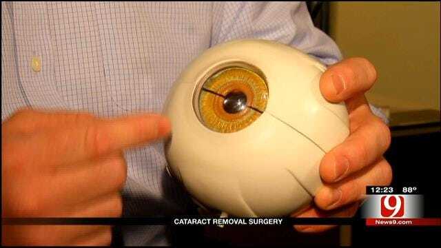 Medical Minute: Cataract Removal Surgery