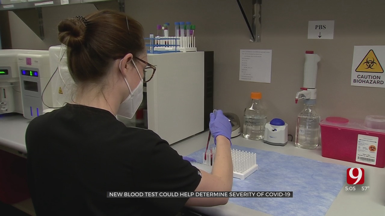 New Blood Test Could Help Determine Severity Of COVID-19