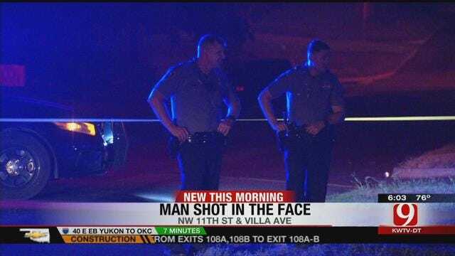 OKC Police: Woman Shoots Boyfriend In Face By Accident