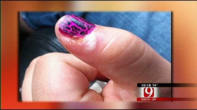 Consumer Watch: Mom Says Manicure Led To Daughter's Infection