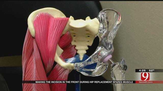 Medical Minute: Hip Replacement