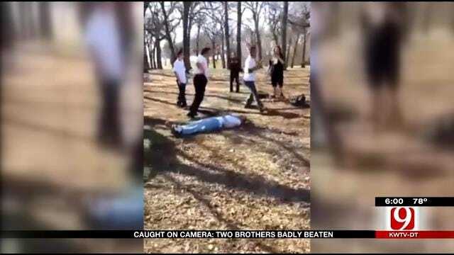 Mother Fears Men Who Brutally Beat Her Son Near PC West High School