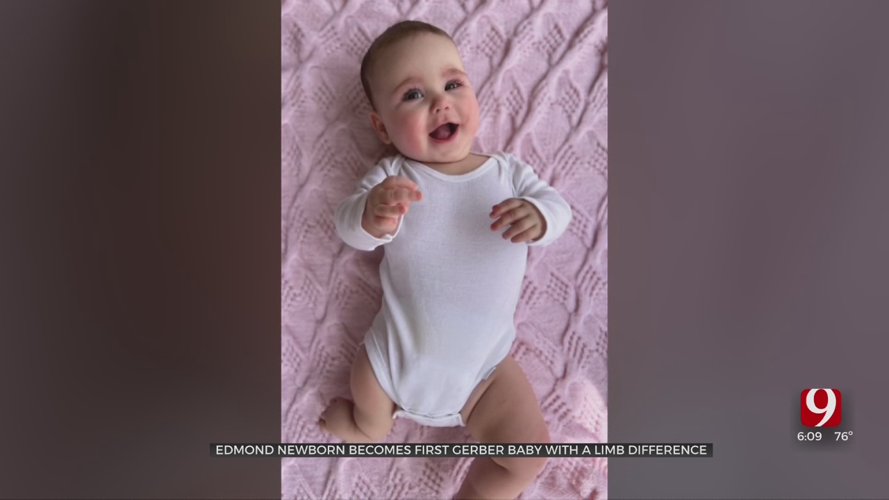Edmond Newborn Makes Gerber Baby History