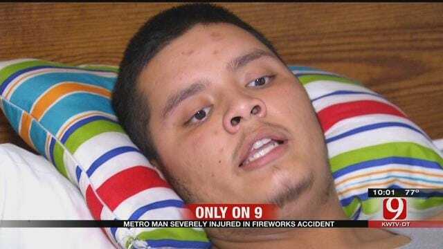 OKC Man Nearly Loses Leg After Fireworks Accident