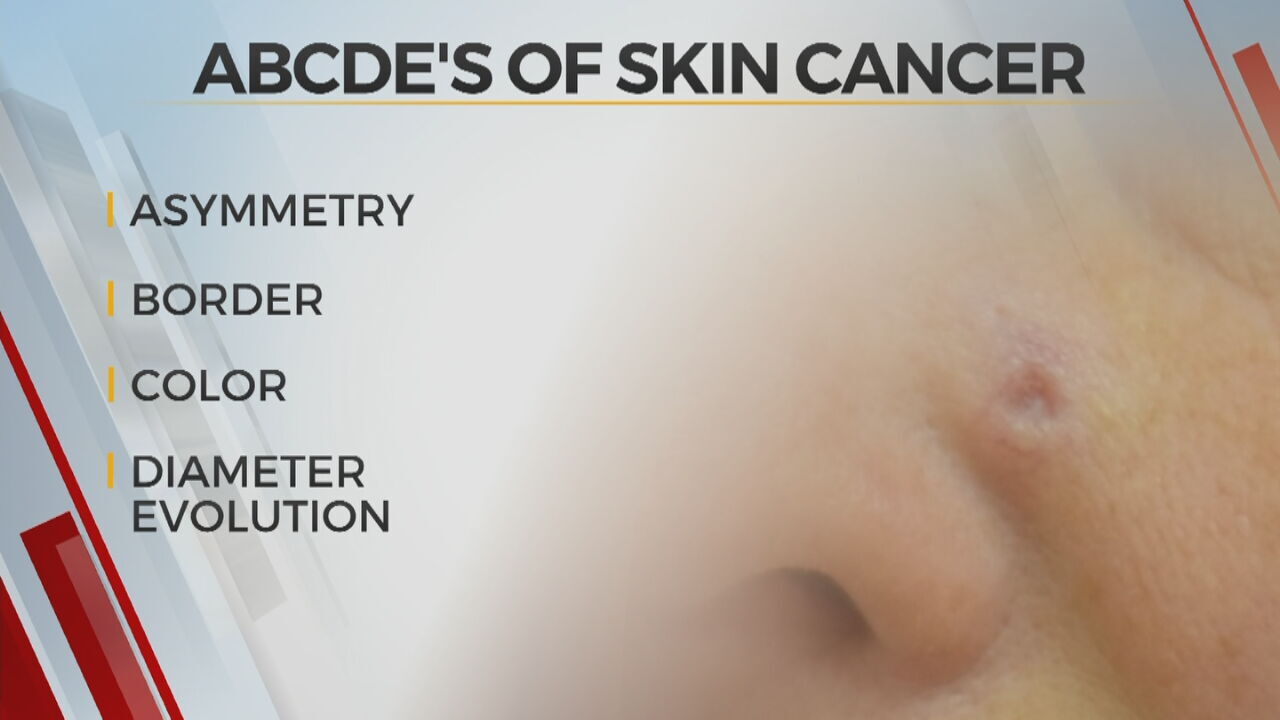 Watch: Dr. Stacy Chronister Offers Tips On Protecting Your Skin This Summer