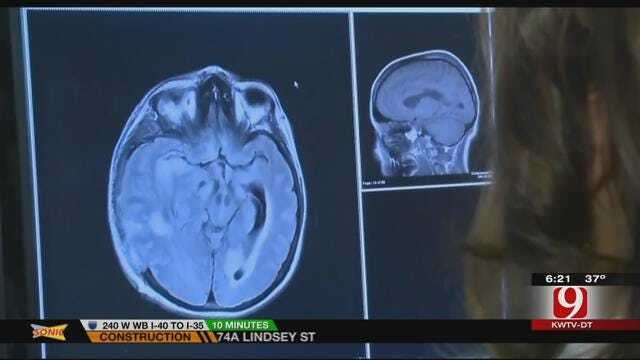 Washington D.C. Rolls Out Program To Assess Concussion In Youth Sports