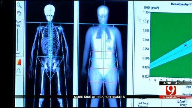 Medical Minute: More Kids At Risk For Rickets