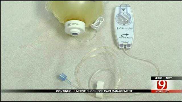 Medical Minute: Continuous Nerve Block For Pain Management