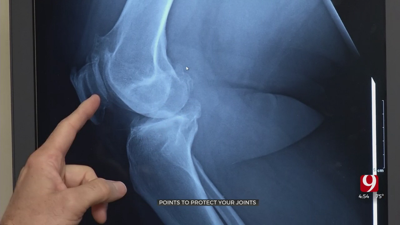 Medical Minute: Points To Protect Your Joints