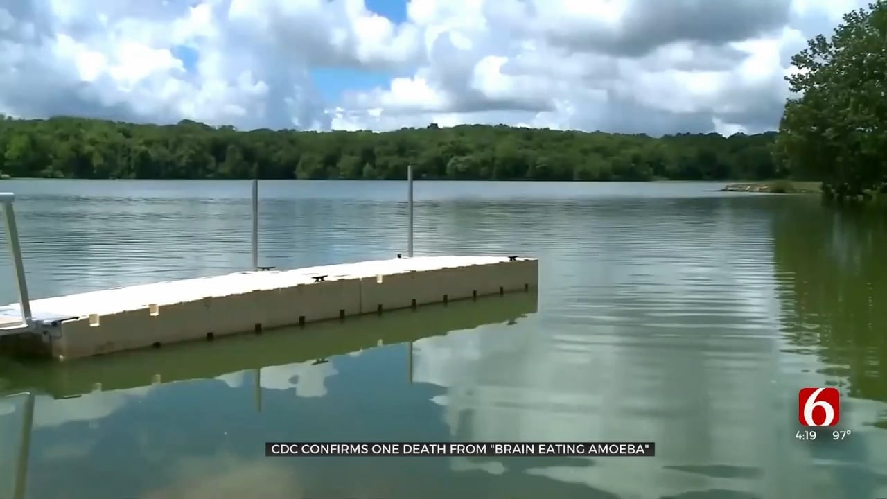 Medical Minute: CDC Confirms 1 Dead From 'Brain-Eating Amoeba'