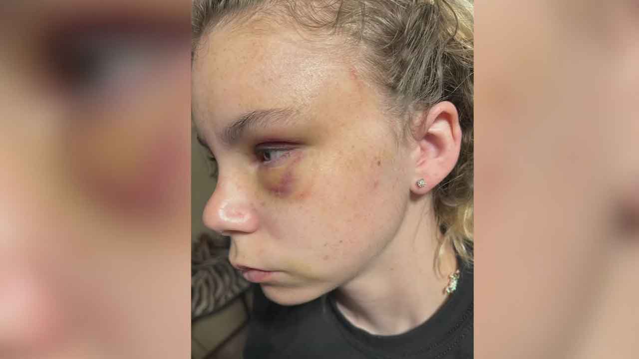 Oklahoma Teen With Cerebral Palsy Lured & Brutally Attacked In Park, Family Says 