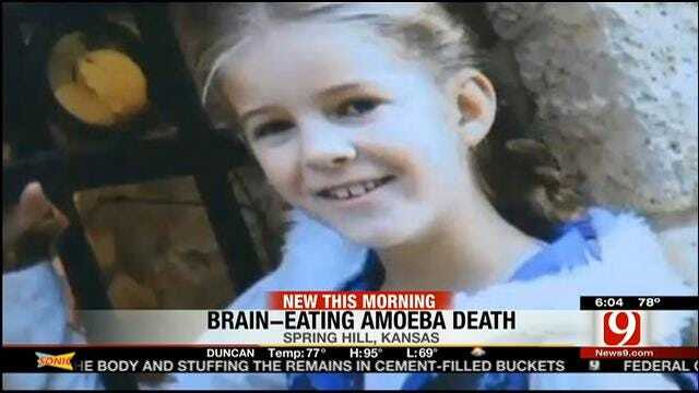 Kansas Girl Dies After Contracting Brain-Eating Amoeba