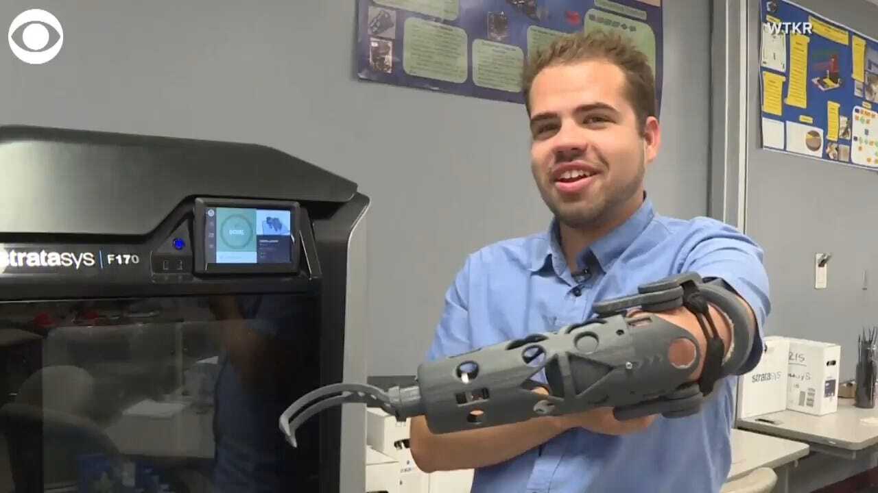 WATCH: College Student Creates His Own Prosthetic Arm