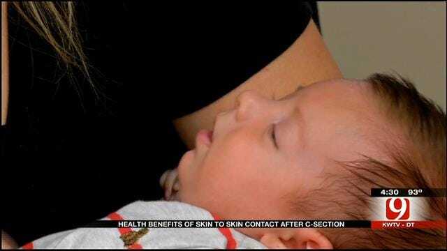Medical Minute: Health Benefits Of Skin-To-Skin Contact After C-Section