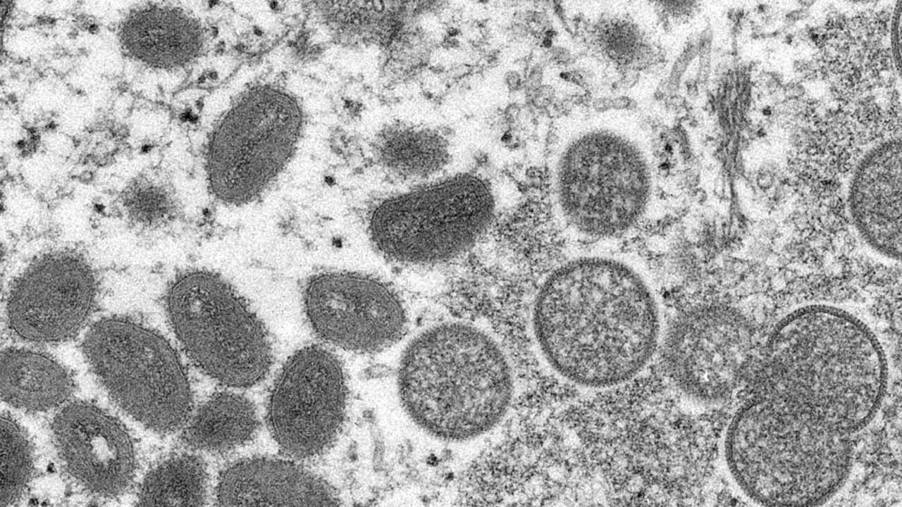 Bavarian Nordic Creating Vaccines To Combat Monkeypox Cases
