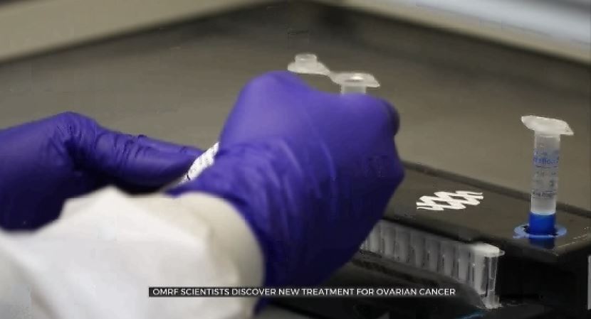 Metro Scientist Discovers New Treatment For Ovarian Cancer 