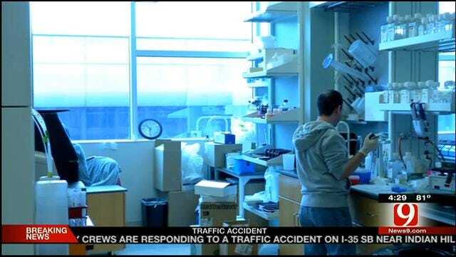 Medical Minute: Lupus Found In Stomach?