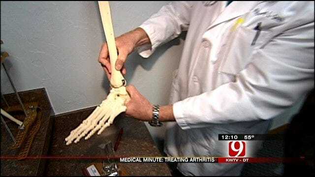 Medical Minute: Scandinavian Total Ankle Replacement