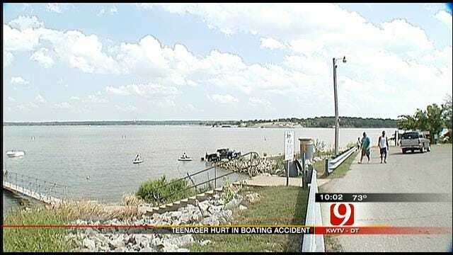 Teen Hit By A Boat On Lake Arcadia
