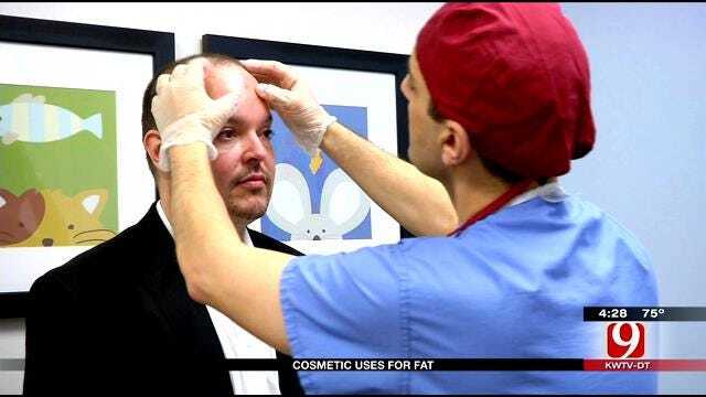 Medical Minute: Cosmetic Uses For Fat